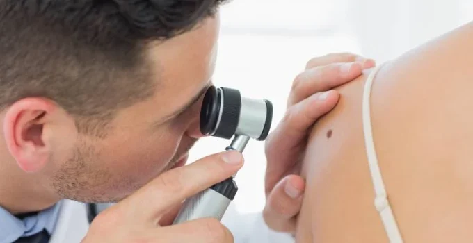 Vacina personalizada contra melanoma mostra redução significativa de risco de retorno da doença