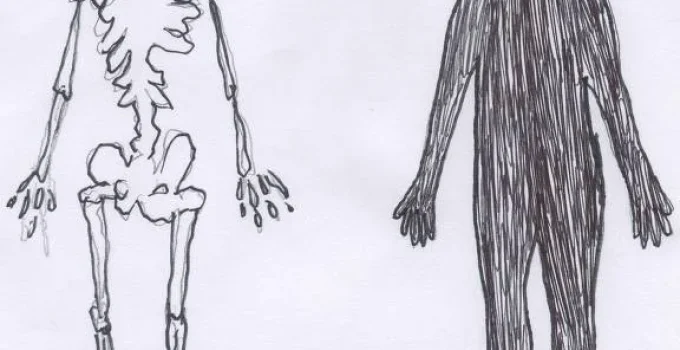 Anorexia e Bulimia: Casos Mundiais Disparam 71% em Duas Décadas