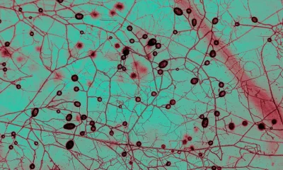 IA e Robôs Revelam Rede Global de Fungos Subterrâneos com Carbono Equivalente a 4x a Humanidade