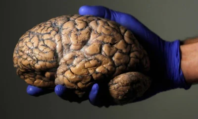 Cérebro Bilíngue: Estudo Revela Surpreendente Integração no Processamento de Dois Idiomas