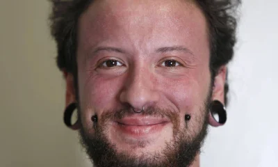 Técnica brasileira de aumento peniano atrai homens trans de todo o mundo para o Brasil