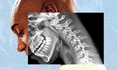 O 'corpo de celular': como o uso excessivo de telas afeta sua saúde física