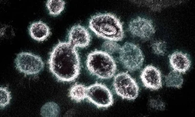Cientistas criam catálogo para identificar vírus com potencial pandêmico