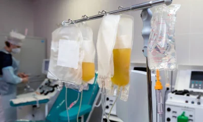 CFM regulamenta uso de plasma rico em plaquetas para quatro condições osteomusculares