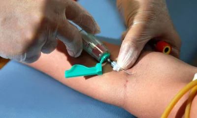Sociedade Americana do Câncer atualiza diretrizes e inclui exames de sangue e fezes no rastreio de câncer colorretal