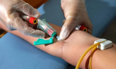 Exame de sangue inovador detecta câncer quatro vezes mais que métodos tradicionais