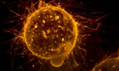 Jovens envelhecem biologicamente mais rápido, aumentando risco de câncer precoce