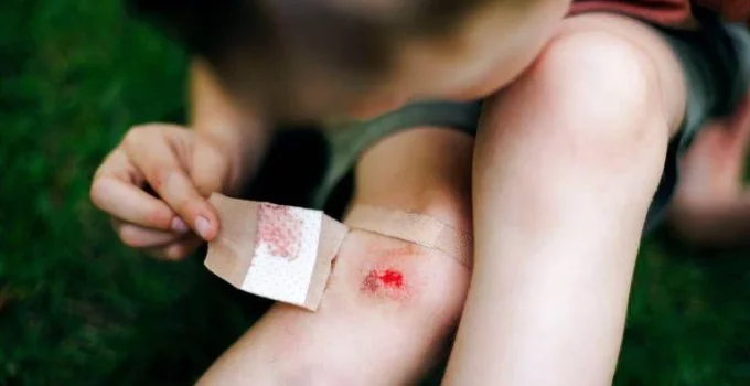 Mercurocromo: O adeus ao icônico 'remédio vermelho' que marcou gerações