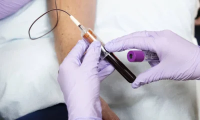 Nova Pílula para Colesterol Aprovada pela FDA Promete Revolucionar o Tratamento