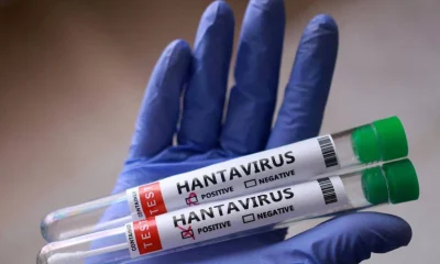 Turista franco-argentino é diagnosticado com hantavírus na França