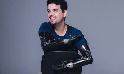 De sobrevivente a empreendedor: jovem tetra-amputado funda empresa de próteses