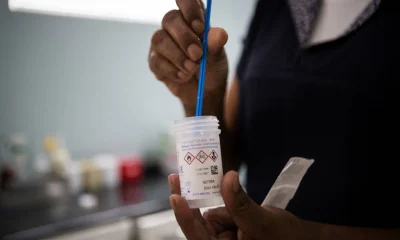 Rastreamento do Câncer de Colo de Útero: Novas Opções e Recomendações Médicas