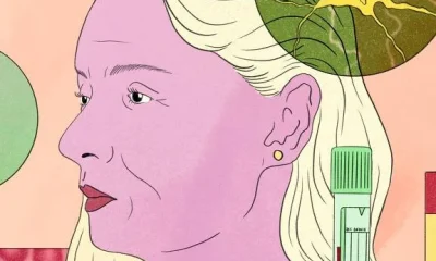 Exame de sangue para Alzheimer nos EUA gera esperança e apreensão; médicos pedem cautela