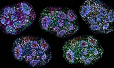 Minicérebros em laboratório demonstram longevidade e recapitulam desenvolvimento humano