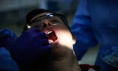 Saliva pode ser chave para detecção precoce de câncer de intestino