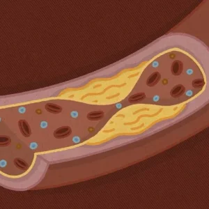 Novos fármacos e adesão ao tratamento: a batalha contra o colesterol alto no Brasil
