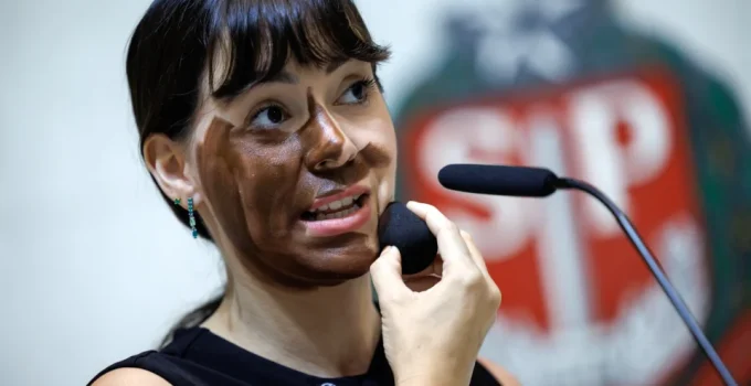 MP de SP defende arquivamento de acusação de racismo contra Fabiana Bolsonaro por 'blackface'