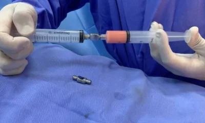 Nanofat: a gordura do próprio corpo que promete rejuvenescer a pele e seus dilemas médicos