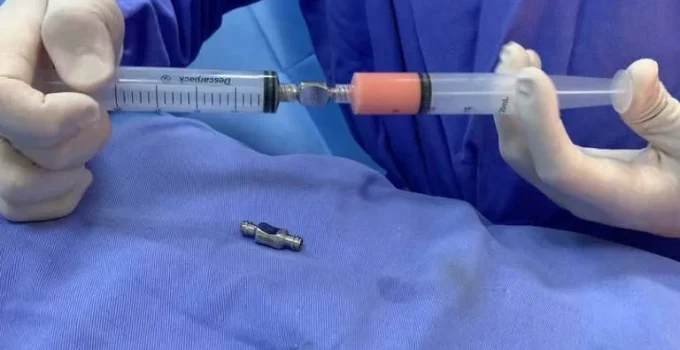 Nanofat: a gordura do próprio corpo que promete rejuvenescer a pele e seus dilemas médicos