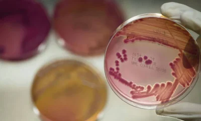 Cientistas descobrem vírus em esgoto do Reino Unido capaz de combater superbactérias
