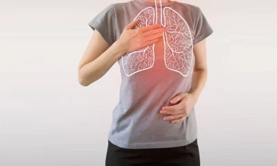 Biomarcadores no Sangue Podem Prever Resposta à Imunoterapia contra Câncer de Pulmão
