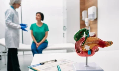 Exame de sangue experimental detecta câncer de pâncreas em estágio inicial com alta precisão
