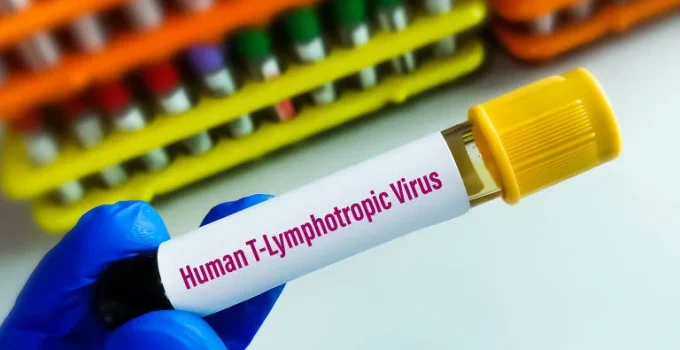 Vírus HTLV-1 pode causar síndrome inflamatória em portadores assintomáticos, aponta estudo
