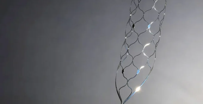 Nova técnica promete desobstruir artérias calcificadas sem o uso de stents