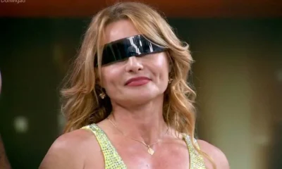 Rita Guedes relata risco de cegueira após blefaroplastia e alerta para complicações
