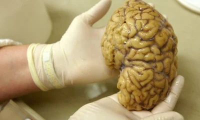 Cientistas Mapeiam Atividade Genética no Córtex Pré-Frontal, Abrindo Caminhos para Tratamentos Neurológicos