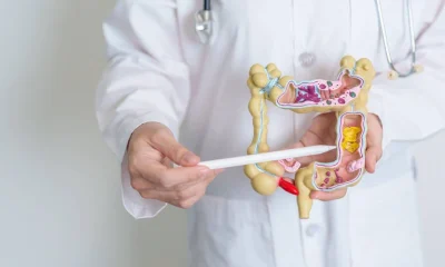 Doenças Inflamatórias Intestinais no Brasil: Crescimento Alarmante de Mais de 400% em 13 Anos