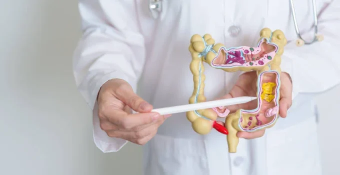 Doenças Inflamatórias Intestinais no Brasil: Crescimento Alarmante de Mais de 400% em 13 Anos