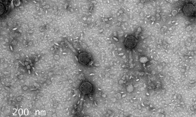 Vipr: Cientistas Descobrem Potencial Nova Ferramenta de Edição Genética em Vírus Antigos