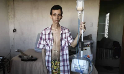 Anos de incerteza: a luta de pacientes com doenças raras por um diagnóstico