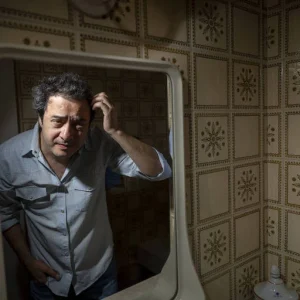 Seis meses após transplante capilar, jornalista relata foliculite e melhora incompleta