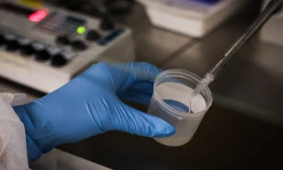 Técnicas adicionais na fertilização in vitro não garantem gravidez, aponta estudo